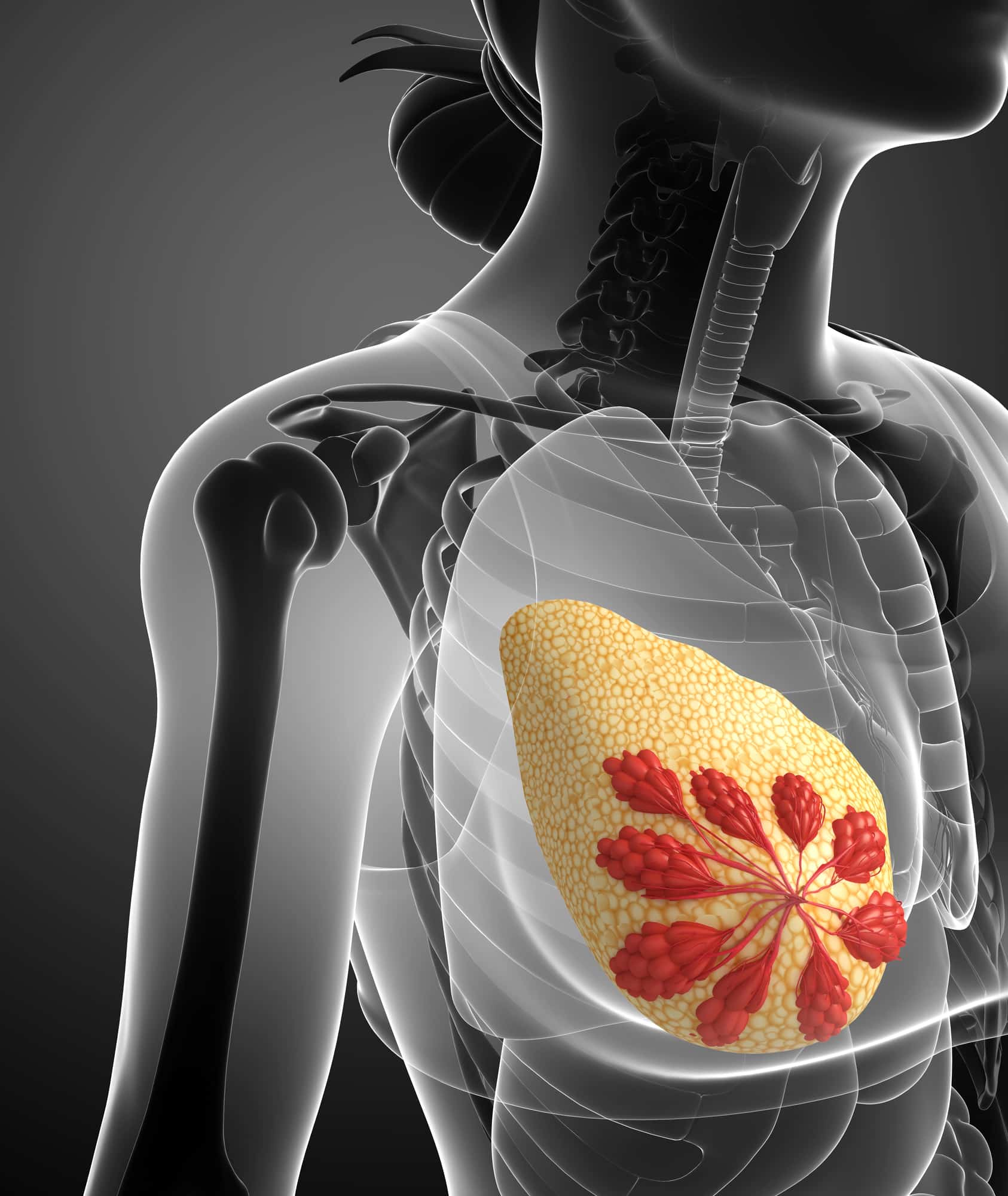 breast cancer prevention